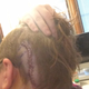 Illustration for article titled Im aliiiiiiiiiiiiiive (ETA: CW: Dem Head Staples)